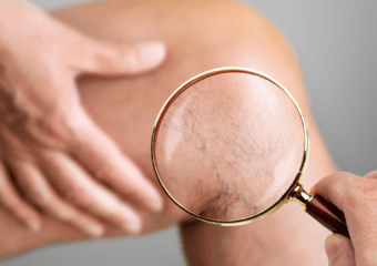 Polispecialistico Maragliano - Chirurgia Vascolare