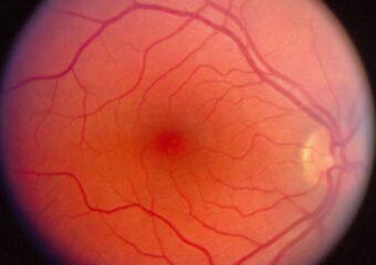 Polispecialistico Maragliano - Tonometria Oculare