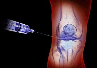 Polispecialistico Maragliano - Infiltrazioni articolari